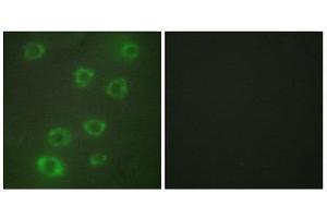 Immunofluorescence (IF) image for anti-Pentraxin 3 (PTX3) (N-Term) antibody (ABIN1849270) (PTX3 Antikörper  (N-Term))