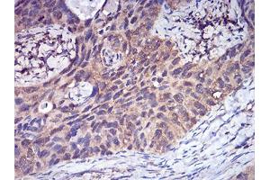 Immunohistochemistry (IHC) image for anti-Complement Factor H-Related 5 (CFHR5) (AA 344-569) antibody (ABIN5542640)