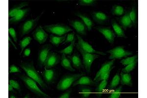 Immunofluorescence of monoclonal antibody to RBBP9 on HeLa cell. (RBBP9 Antikörper  (AA 87-185))