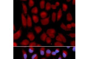 Immunofluorescence analysis of U2OS cells using TAP2 Polyclonal Antibody (TAP2 Antikörper)