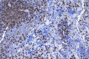 IHC analysis of CD5 using anti-CD5 antibody (ABIN7600839). (CD5 Antikörper  (AA 24-494))