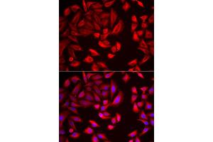 Immunofluorescence analysis of HeLa cell using CCT2 antibody.