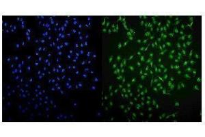 IF analysis of UHRF1 using anti-UHRF1 antibody (ABIN3044567).