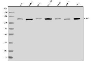 Western blot analysis of XRN2 using anti-XRN2 antibody (ABIN7601894).
