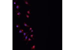 ABIN6276842 staining HepG2? (PLGF Antikörper  (Internal Region))