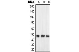 Western blot analysis of GPR83 expression in HeLa (A), Jurkat (B), HuvEc (C) whole cell lysates.