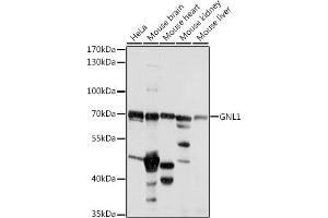 Western blot analysis of extracts of various cell lines, using GNL1 antibody (ABIN7267543) at 1:1000 dilution. (GNL1 Antikörper  (AA 1-180))