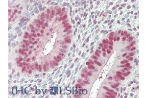IHC-P analysis of Human Uterus Tissue, with HE staining. (Nucleolin Antikörper  (AA 388-569))