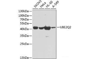Western blot analysis of extracts of various cell lines using UBE2Q2 Polyclonal Antibody at dilution of 1:1000. (UBE2Q2 Antikörper)