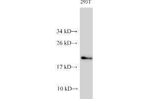 Western Blot analysis of 293T cells using CDK4 Polyclonal Antibody at dilution of 1:1000 (CDK4 Antikörper)