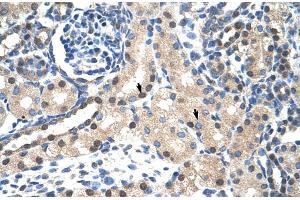 Rabbit Anti-STAT1 Antibody  Paraffin Embedded Tissue: Human Kidney Cellular Data: Epithelial cells of renal tubule Antibody Concentration: 4. (STAT1 Antikörper  (N-Term))