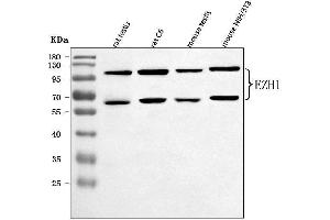 Western blot analysis of EZH1 using anti-EZH1 antibody (ABIN7601019).