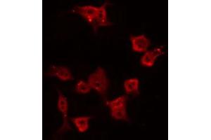 ABIN6269329 staining NIH-3T3 by IF/ICC. (PKC delta Antikörper)