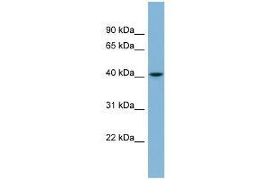 WB Suggested Anti-SERPINI1 Antibody Titration: 0. (Neuroserpin Antikörper  (Middle Region))