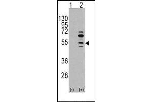Image no. 1 for anti-Myocyte Enhancer Factor 2C (MEF2C) (Ser59) antibody (ABIN358803) (MEF2C Antikörper  (Ser59))