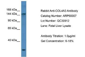 WB Suggested Anti-COL4A3  Antibody Titration: 0.