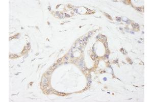 Immunohistochemistry (IHC) image for anti-Ubiquitin Specific Peptidase 5 (USP5) (AA 375-425) antibody (ABIN7449032) (USP5 Antikörper  (AA 375-425))
