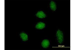 Immunofluorescence (IF) image for anti-DnaJ (Hsp40) Homolog, Subfamily B, Member 6 (DNAJB6) (AA 1-326) antibody (ABIN523418)