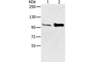 Western Blot analysis of Mouse muscle and heart tissue using ACTN2 Polyclonal Antibody at dilution of 1:300 (ACTN2 Antikörper)