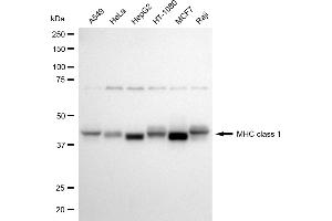 Western blotting analysis using MHC class 1 antibody (ABIN7799404).