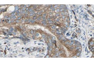 ABIN6277589 at 1/100 staining Human prostate tissue by IHC-P.