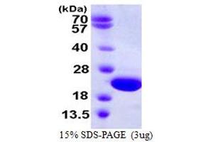SDS-PAGE (SDS) image for Crystallin, gamma D (CRYGD) (AA 1-174) protein (His tag) (ABIN667535)