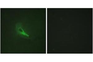 Immunofluorescence analysis of HeLa cells, using AKAP12 Antibody. (AKAP12 Antikörper  (AA 301-350))
