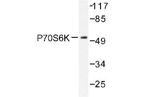 Image no. 1 for anti-Ribosomal Protein S6 Kinase, 70kDa, Polypeptide 1 (RPS6KB1) antibody (ABIN272053) (RPS6KB1 Antikörper)