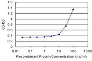 Sandwich ELISA detection sensitivity ranging from 3 ng/mL to 100 ng/mL. (CBS (Human) Matched Antibody Pair)
