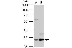 WB Image Annexin V antibody detects ANXA5 protein by Western blot analysis. (Annexin V Antikörper)
