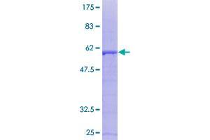 SDCBP Protein (AA 1-298) (GST tag)