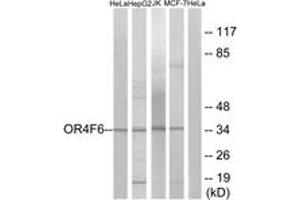 Western blot analysis of extracts from HeLa/Jurkat/HepG2/MCF-7 cells, using OR4F6 Antibody.