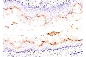 IHC analysis of DHFR using anti-DHFR antibody (ABIN6719418). (Dihydrofolate Reductase Antikörper  (AA 2-187))