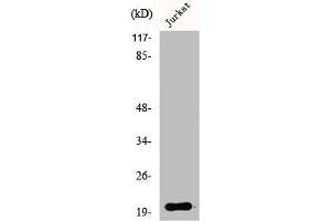 Western Blot analysis of Jurkat cells using AK6 Polyclonal Antibody (TAF9 Antikörper  (N-Term))