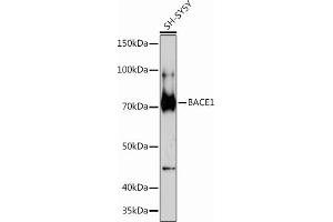 Western blot analysis of extracts of SH-SY5Y cells, using B Rabbit mAb (ABIN7265879) at 1:1000 dilution. (BACE1 Antikörper)
