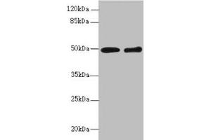 Western blot All lanes: ZBTB25 antibody at 1. (ZBTB25 Antikörper  (AA 266-435))