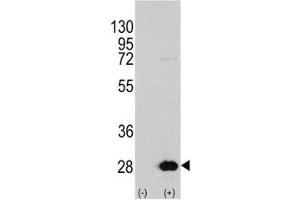 Western blot analysis of HSPB1 antibody and 293 cell lysate either nontransfected (Lane 1) or transiently transfected with the HSPB1 gene (2).
