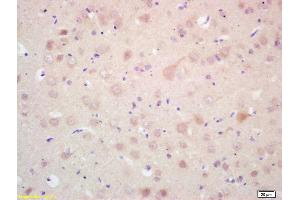 Formalin-fixed and paraffin embedded rat brain labeled with Rabbit Anti MAP LC3 Beta Polyclonal Antibody, Unconjugated (ABIN1386128) at 1:200 followed by conjugation to the secondary antibody and DAB staining (MAP1LC3A/B Antikörper  (AA 25-121))