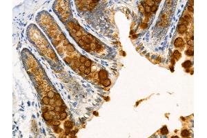 ABIN6258661 and ABIN6274799 at 1/100 staining Rat stomach tissue by IHC-P.