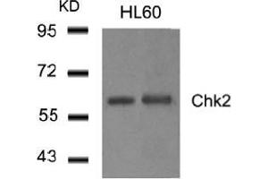 Western blot analysis of extract from HL60 cells using Chk2. (CHEK2 Antikörper  (AA 514-518))