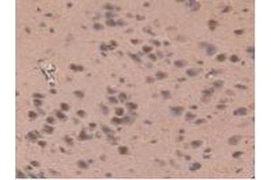 IHC-P analysis of Rat Brain Tissue, with DAB staining. (IL17RD Antikörper  (AA 356-605))