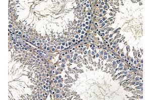 ABIN6257715 and ABIN6275291 at 1/100 staining rat testis tissue by IHC-P.