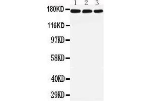 Anti-LRP5 antibody, All Western blottingAll lanes: Anti-LRP5 at 0. (LRP5 Antikörper  (C-Term))