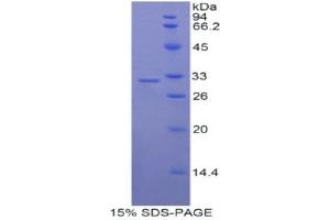 SDS-PAGE analysis of Rat Myosin IC Protein.