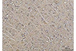 IHC analysis of YWHAE using anti-YWHAE antibody (ABIN7600163).