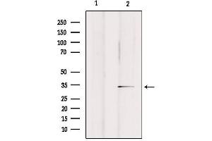 Western blot analysis of extracts from rat brain, using OR2A25 Antibody.