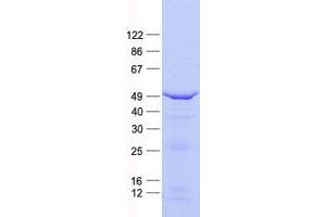Western Blotting (WB) image for Forkhead Box I1 (FOXI1) protein (His tag) (ABIN2721358)