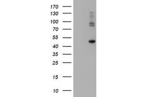 Image no. 2 for anti-Carboxypeptidase A2 (Pancreatic) (CPA2) antibody (ABIN1497595) (Carboxypeptidase A2 Antikörper)