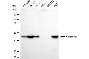 Western blotting analysis using keratin 18 antibody (ABIN7799174).