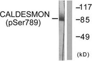 Western blot analysis of extracts from HeLa cells treated with EGF 200ng/ml 30', using Caldesmon (Phospho-Ser789) Antibody. (Caldesmon Antikörper  (pSer789))